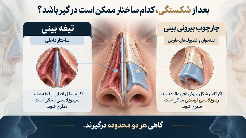 بعد از شکستگی، کدام ساختار ممکن است درگیر باشد؟