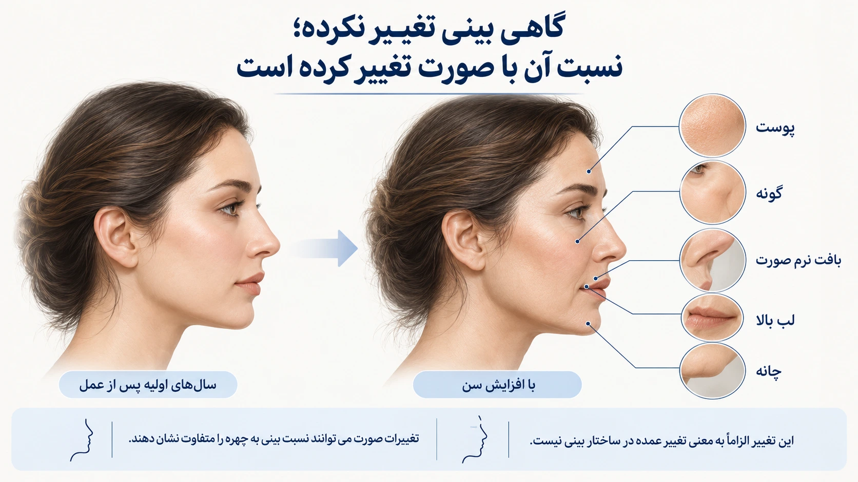 تأثیر تغییرات پوست، لب بالا، گونه و چانه بر نسبت ظاهری بینی به صورت