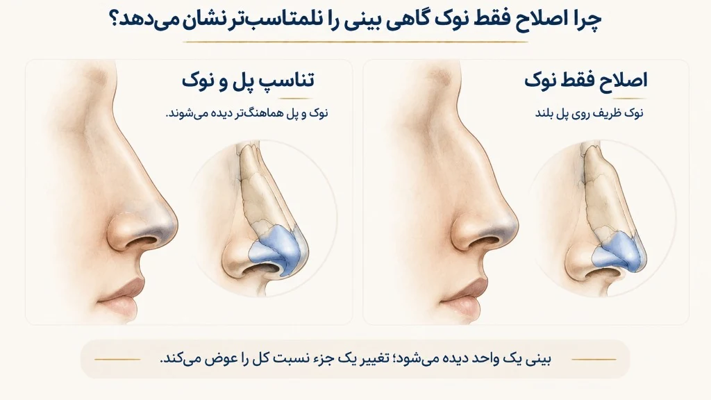 اثر تغییر یک جزء روی نسبت کل بینی