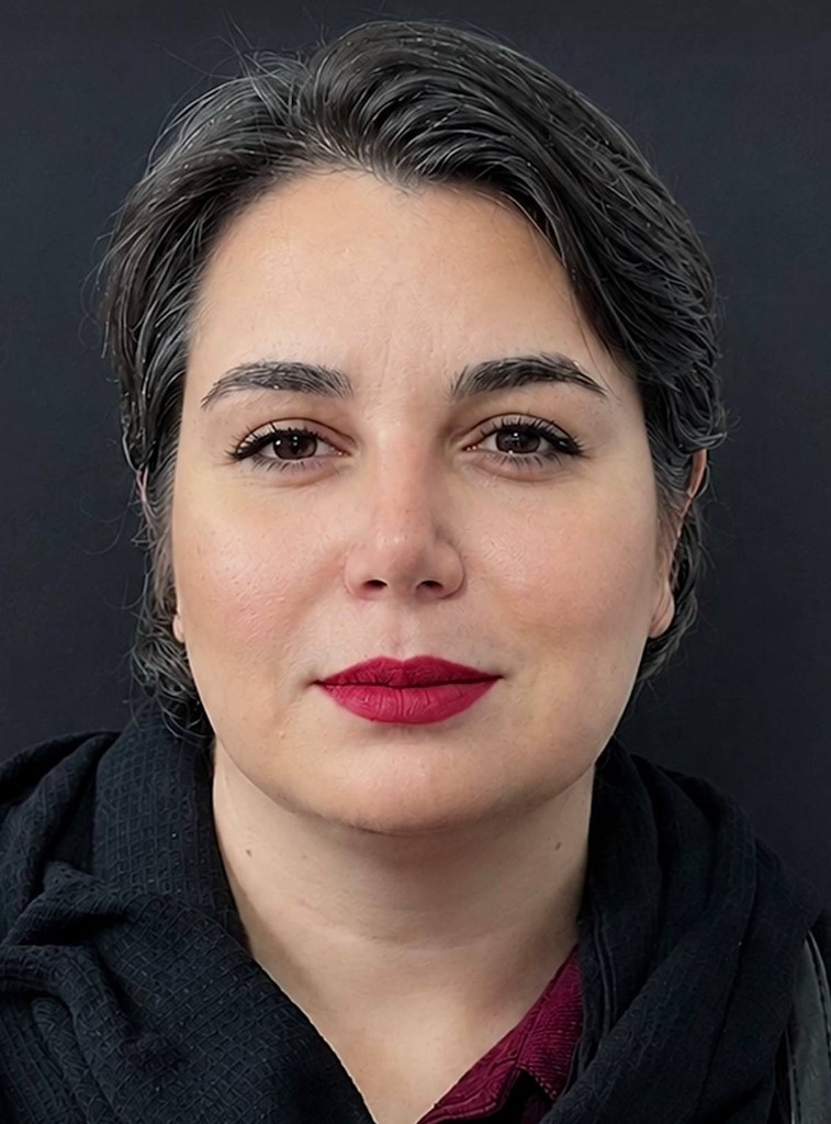 بعد — نتیجه جراحی زیبایی بینی — نمونه ۲