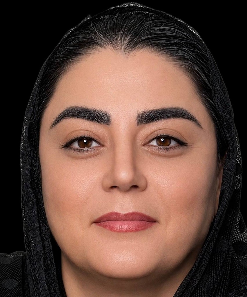 بعد — نتیجه جراحی زیبایی بینی — نمونه ۸
